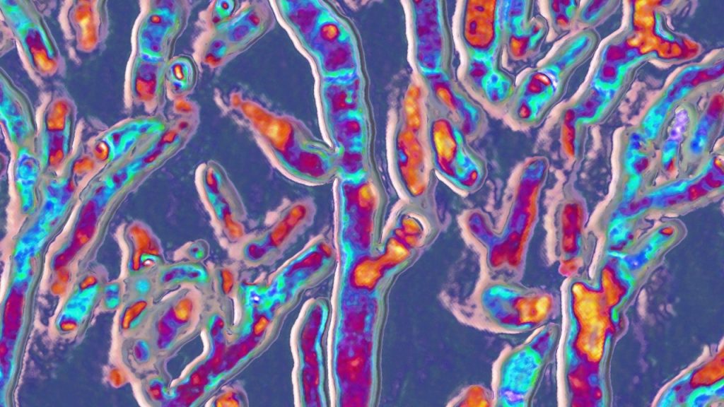 Οι δυνητικά θανατηφόρες μυκητιασικές λοιμώξεις ανεβαίνουν κατά τη διάρκεια της πανδημίας COVID, λέει ο ΠΟΥ