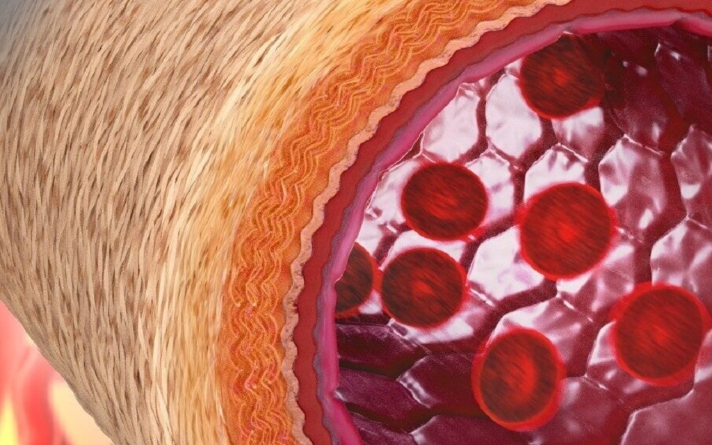 Νέα Τεχνολογία: Επιτρέπει την κατασκευή υλικών που μιμούνται τη δομή των ζωντανών αιμοφόρων αγγείων
