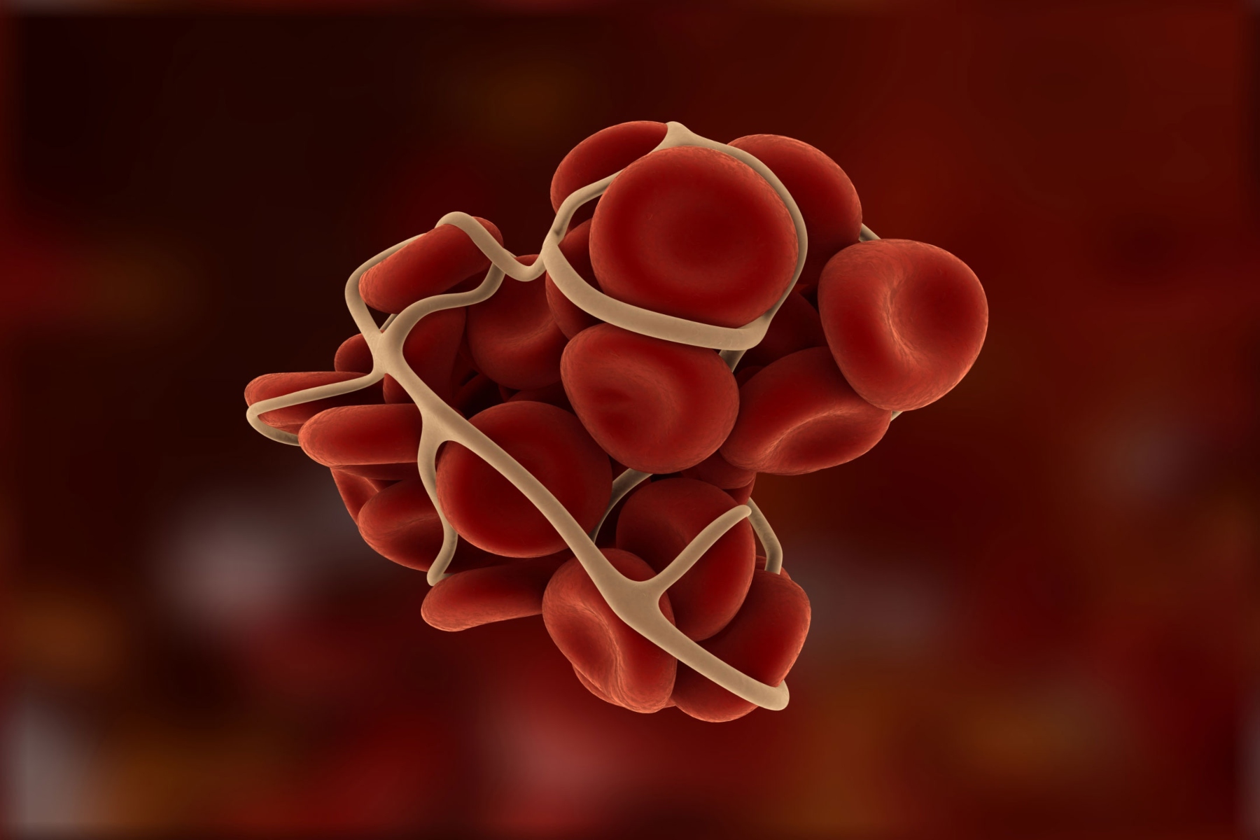 Αιμορροφιλία: Ελπίδες μέσα από την εξέλιξη της γονιδιακής θεραπείας