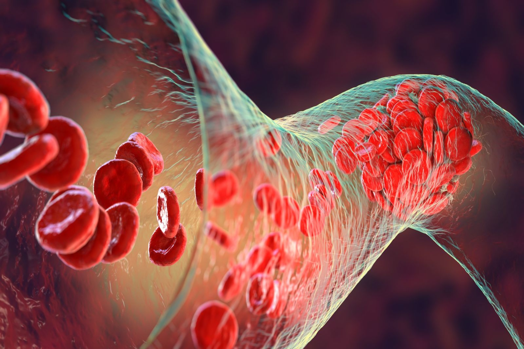 Αίμα: Ερευνητές δοκιμάζουν μεταγγίσεις εργαστηριακού αίματος