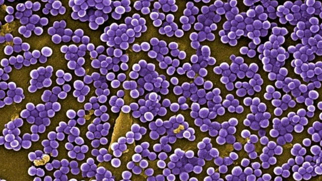 Ινστιτούτο Τεχνολογίας του Ισραήλ: Ερευνητές ανακαλύπτουν συνδυασμούς αντιβιοτικών που μειώνουν την κάθαρση του Staphylococcus aureus