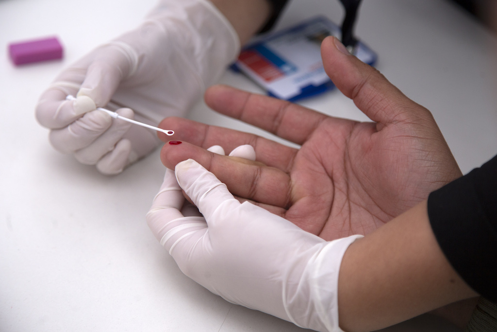 Πανεπιστήμιο της Οξφόρδης: Θεραπευτικό εμβόλιο κατά του HIV επιτυγχάνει ενθαρρυντικά αποτελέσματα