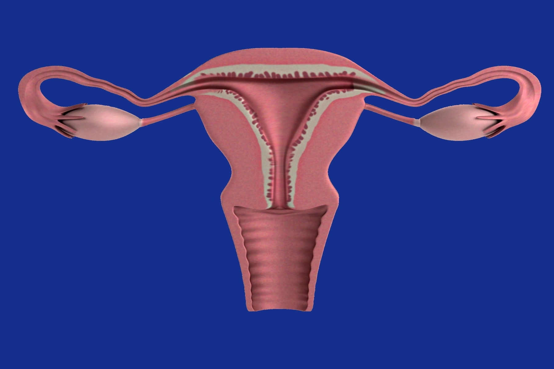 Σεξουαλική υγεία: Σύνδρομο πολυκυστικών ωοθηκών