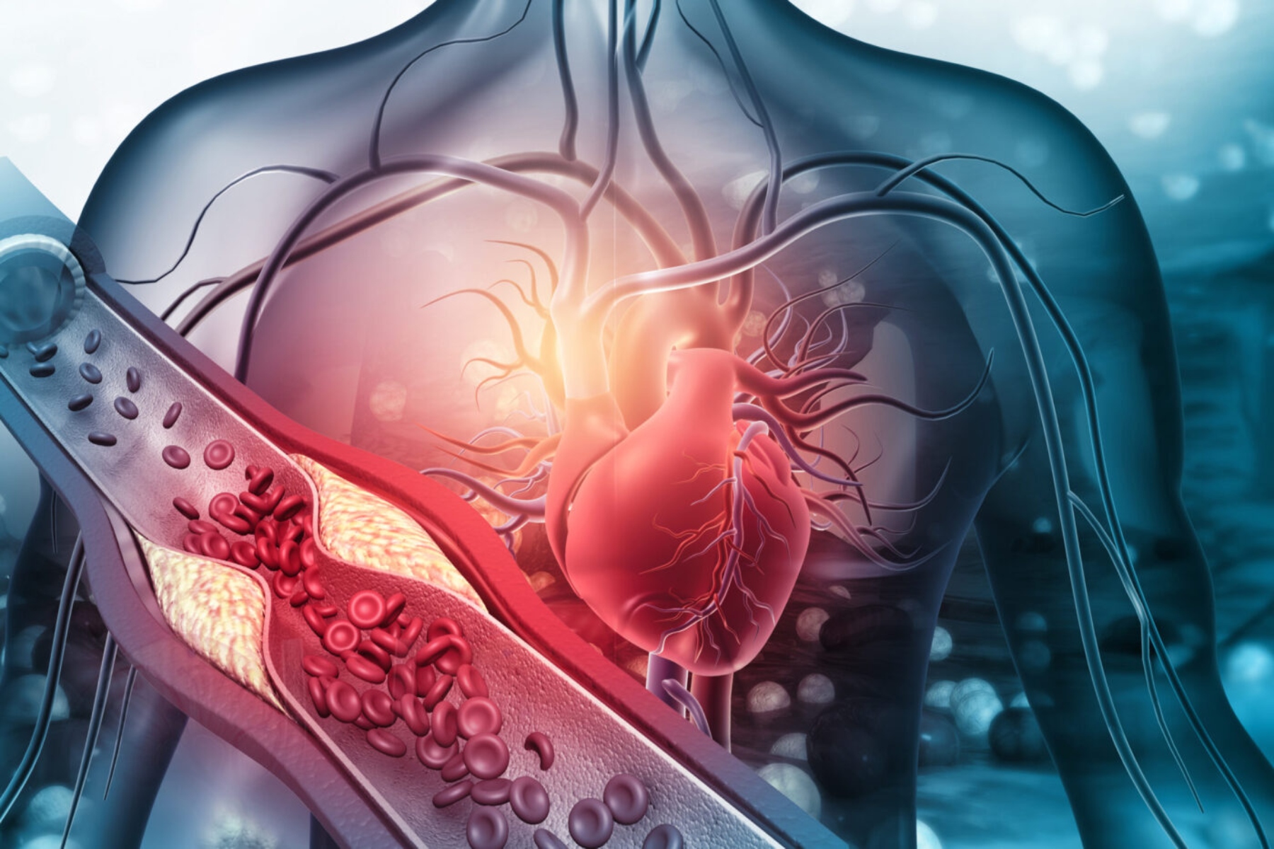 Καρδιά: Αύξηση των καρδιακών προσβολών τις τελευταίες 2 εβδομάδες του Δεκεμβρίου