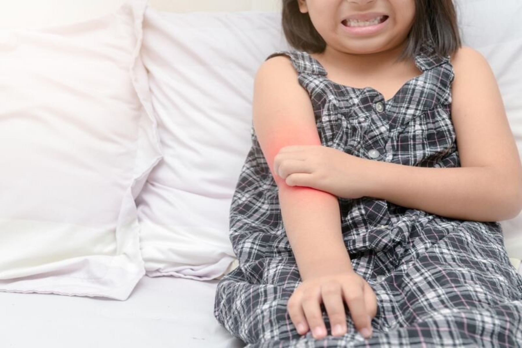 Ατοπική δερματίτιδα: Αυξάνει τον επακόλουθο κίνδυνο κατάγματος στα παιδιά