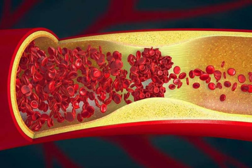 Στοχεύοντας την αναδιοργάνωση της δομής των αιμοφόρων αγγείων
