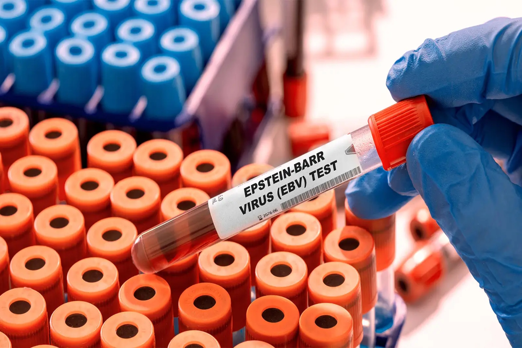 Epstein-Barr ιός: Η παρακολούθηση του ιού μειώνει τον κίνδυνο μεταμόσχευσης ήπατος