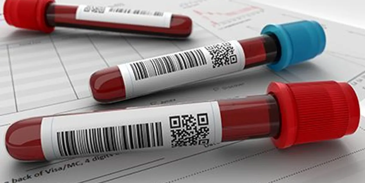 Απλή Εξέταση Αίματος: Υπόσχεται να ελέγξει κοινές και επικίνδυνες επιπλοκές της εγκυμοσύνης