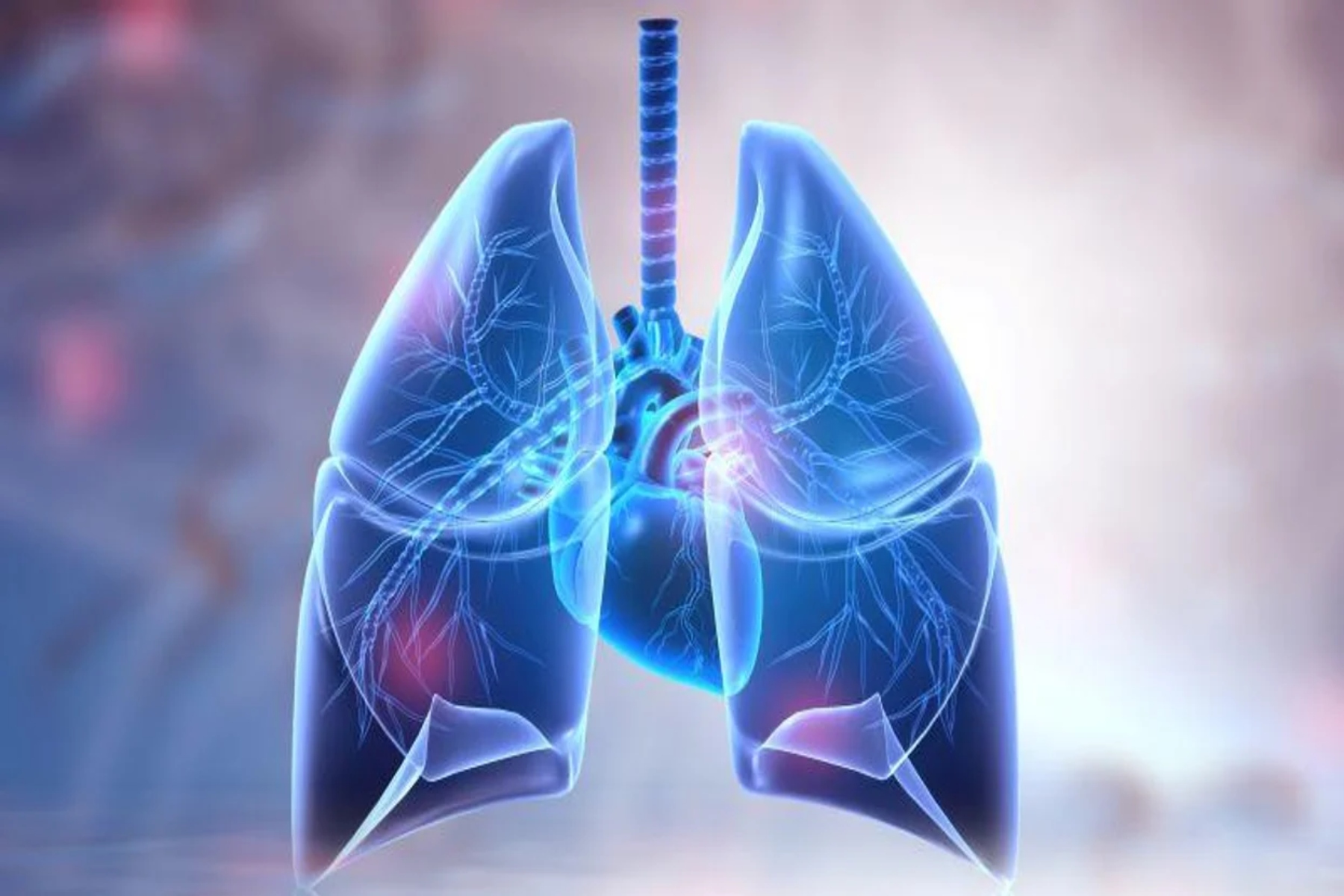 Γαστροοισοφαγική παλινδρόμηση: Αιτιώδης σχέση με κίνδυνο καρκίνου του πνεύμονα