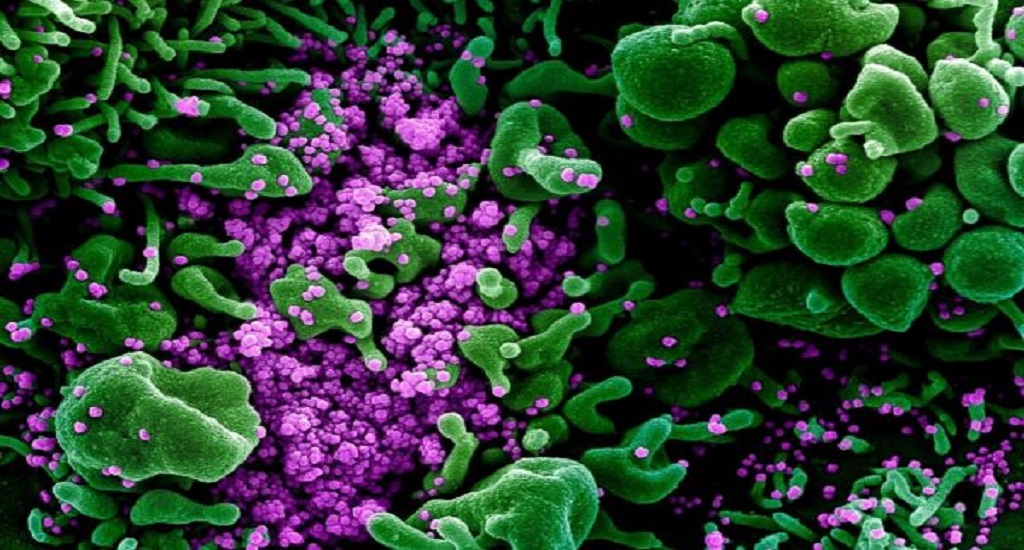 Συσχετίσεις έχουν βρεθεί μεταξύ του ιού του έρπη και της νόσου Αλτσχάιμερ & μεταξύ του ιού της γρίπης και της νόσου Πάρκινσον