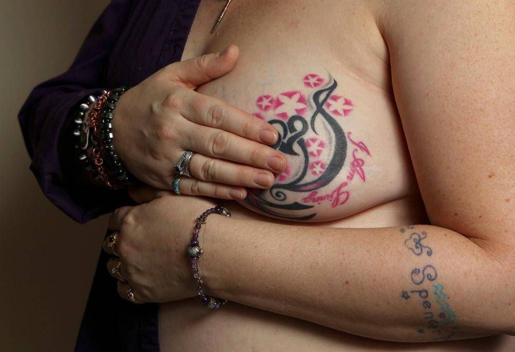 Δωρεάν Τατουάζ: Δίνουν ελπίδα στις Ολλανδέζες επιζώσες του καρκίνου του μαστού