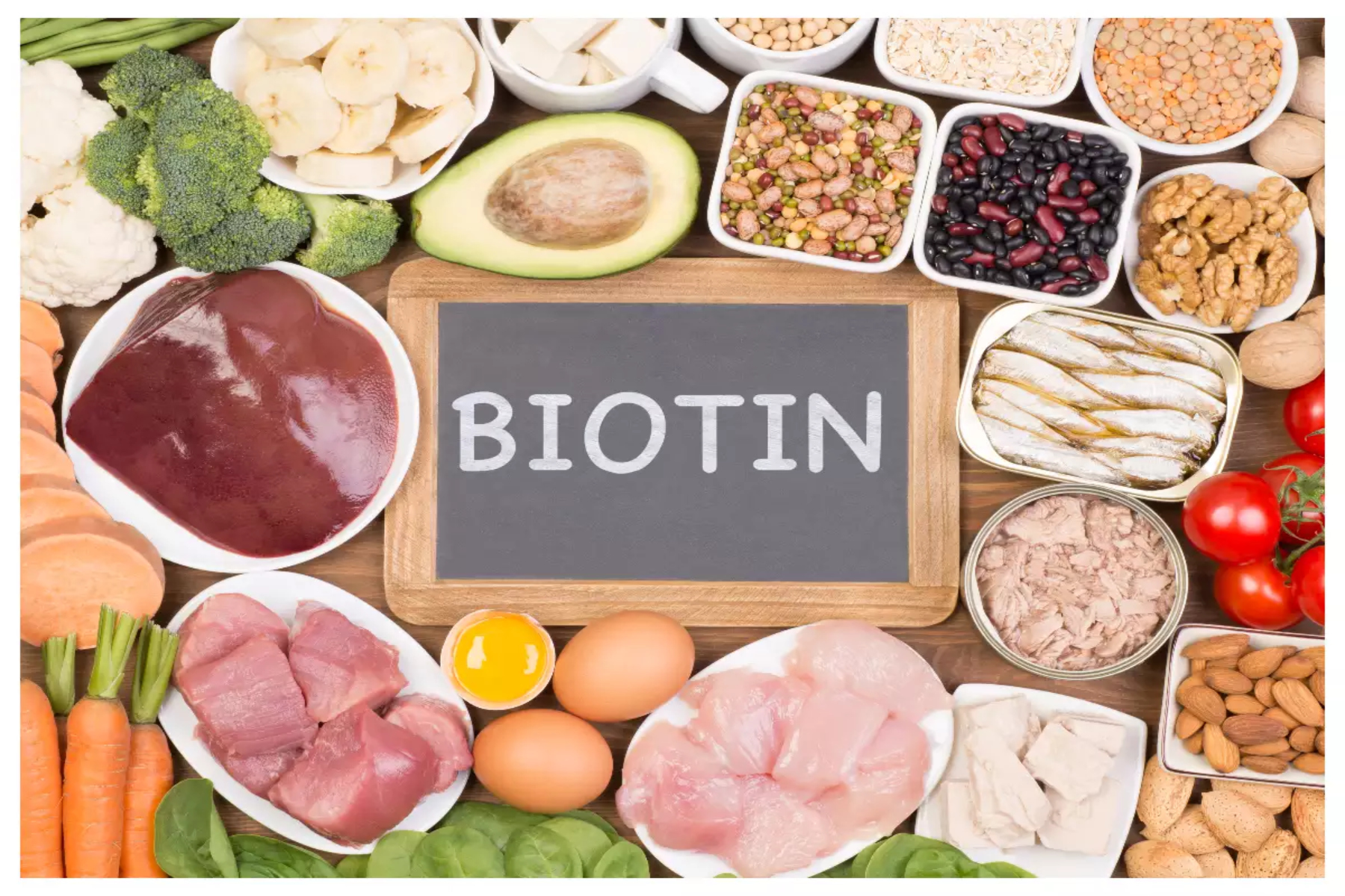 Βιοτίνη: Ποιες τροφές περιέχουν βιοτίνη;