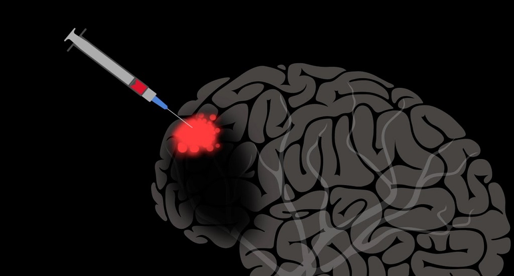 Νευροπλαστικότητα: Αξιοποίηση της ικανότητας του εγκεφάλου να αυτοθεραπεύεται