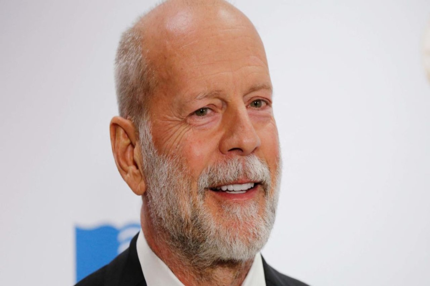 Bruce Willis: Ο γνωστός ηθοποιός πάσχει από μετωποκροταφική άνοια