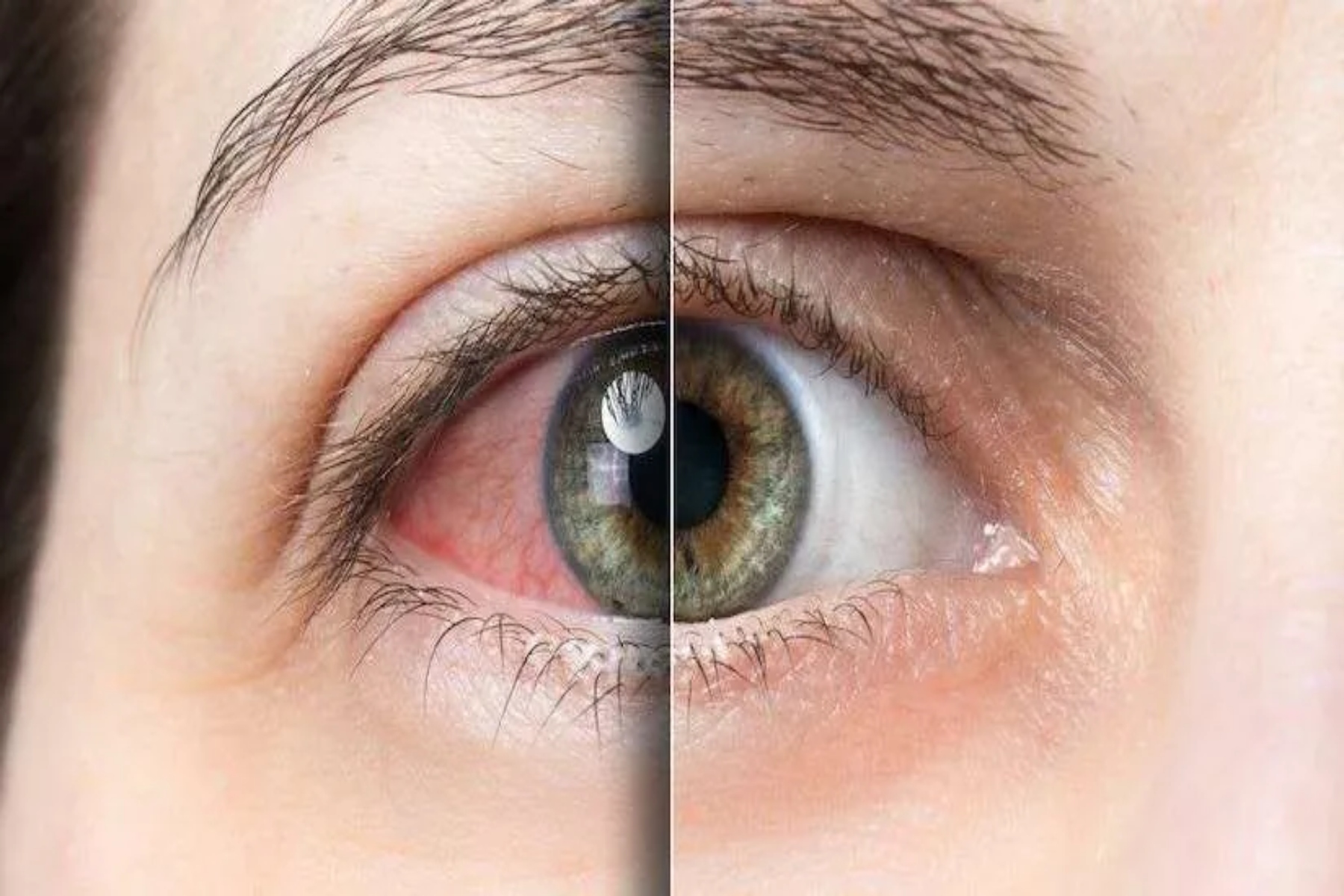 Οφθαλμική υγεία: Καταπόνηση των ματιών από ψηφιακές οθόνες