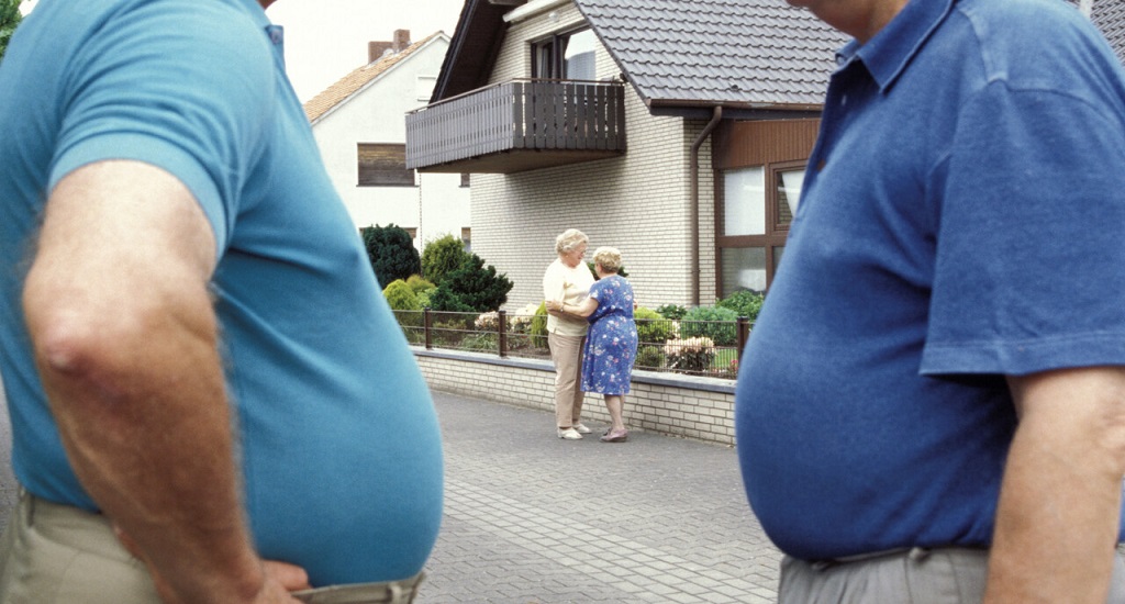 Σοβαρή Παχυσαρκία: Είναι πιο επικίνδυνη για τους Σουηδούς άνδρες από τους Αμερικανούς άνδρες, σύμφωνα με διατριβή