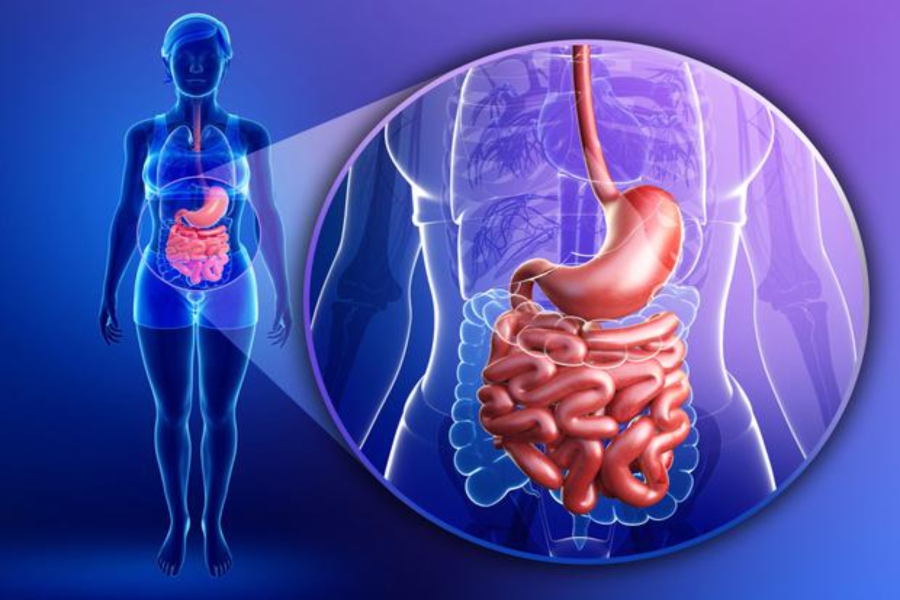 Νόσος του Crohn: Σχέση μεταξύ υπερεπεξεργασμένων τροφίμων και της νόσου