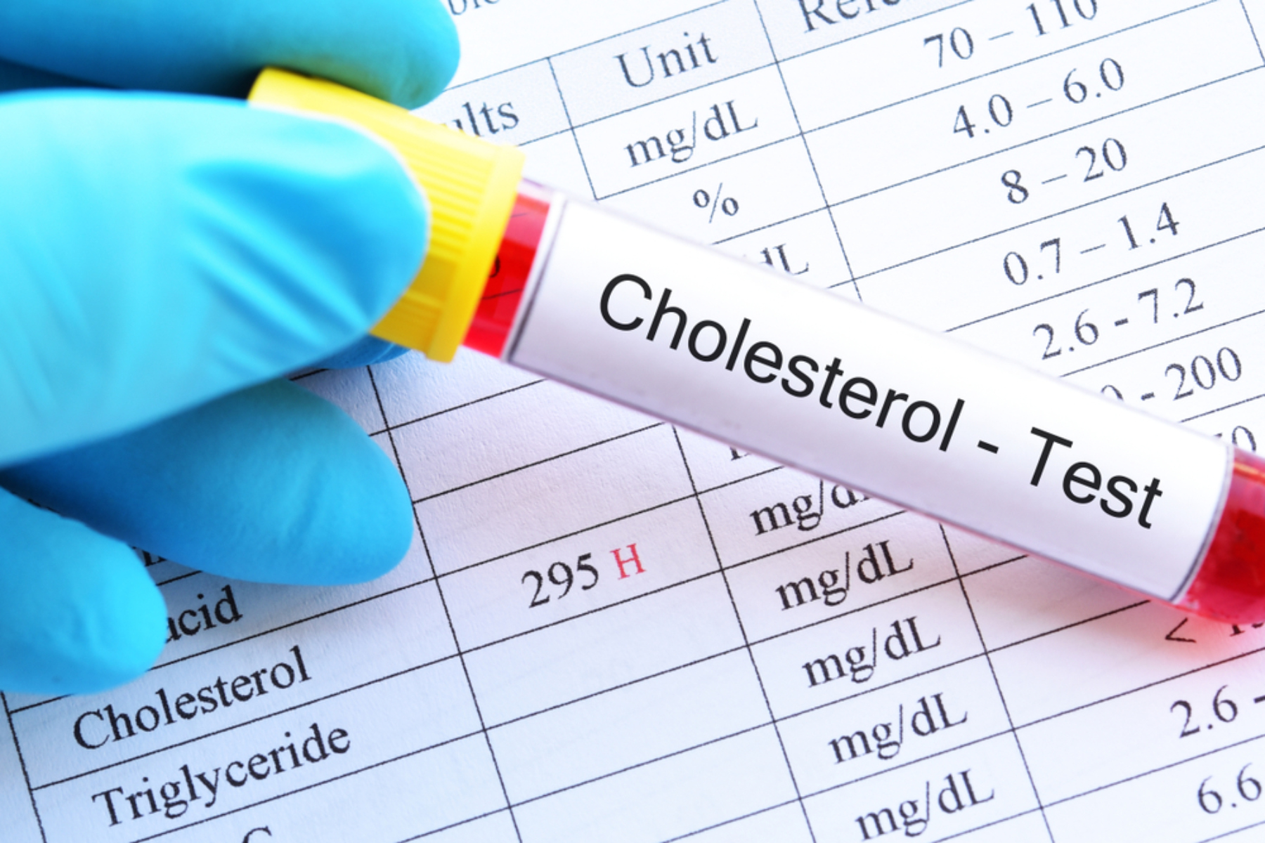 Χοληστερόλη: Είναι απαραίτητη η χοληστερόλη για το αίμα μας;
