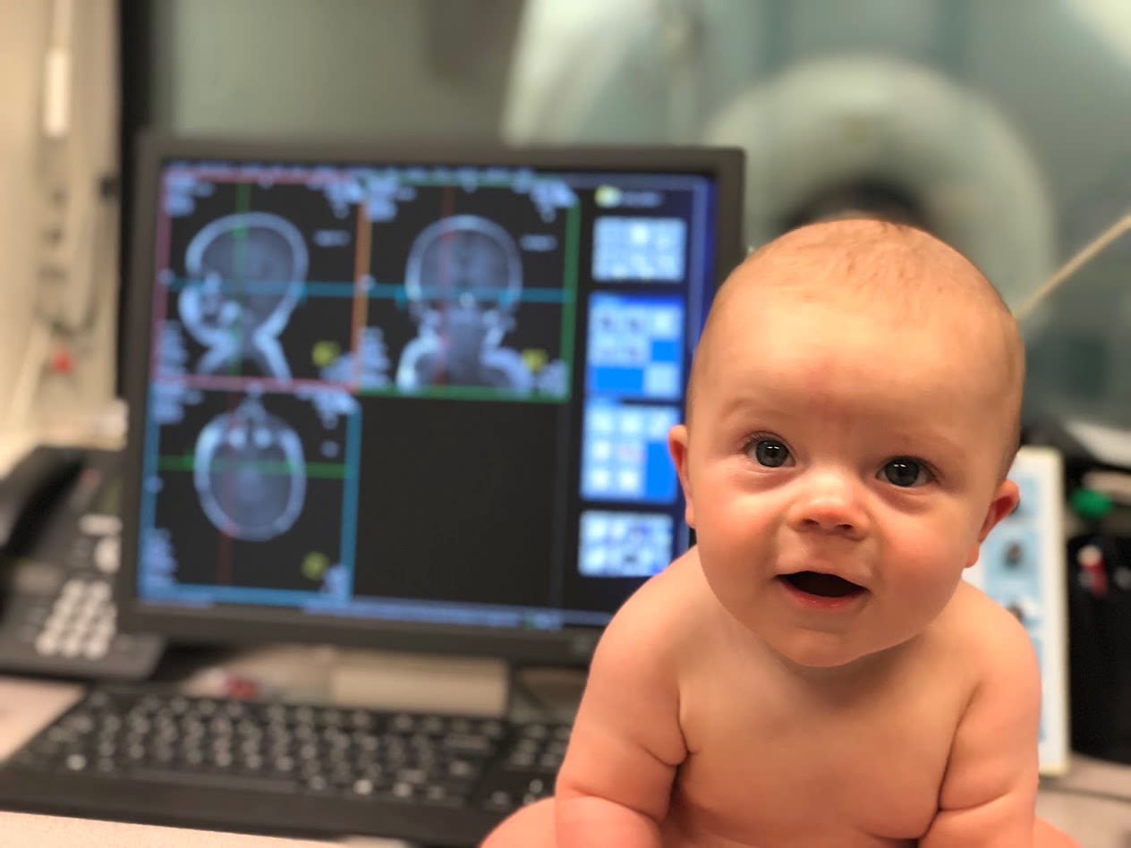 Εγκεφαλικές Διαταραχές: Οι εγκέφαλοι των νεογέννητων μωρών αποκαλύπτουν νέες γνώσεις για την ανάπτυξη του παιδιού
