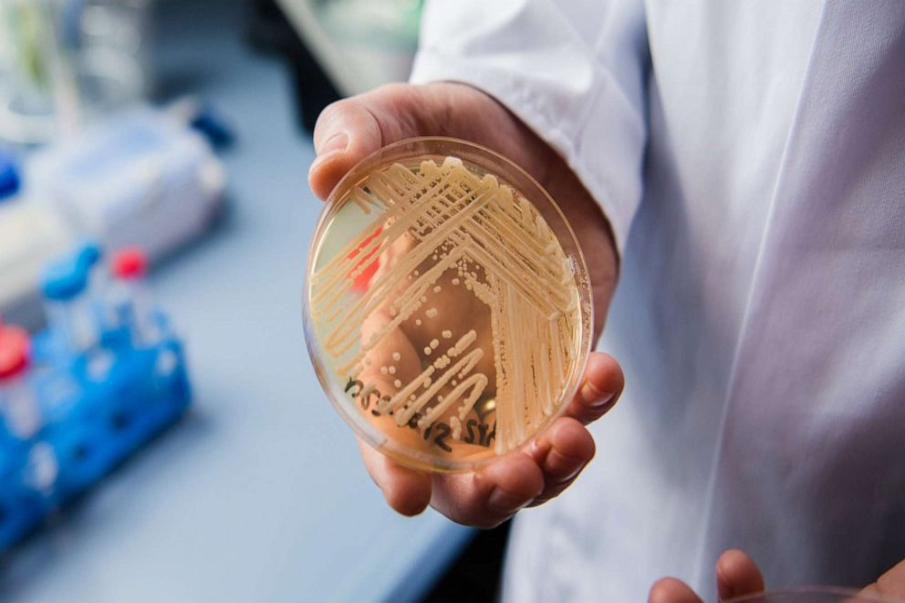 Candida auris: Δυνητικά θανατηφόρος μύκητας εξαπλώνεται στις εγκαταστάσεις υγείας των ΗΠΑ