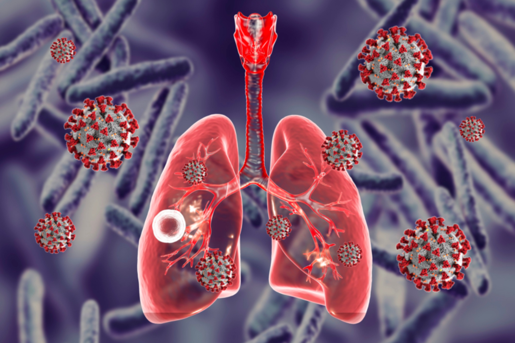 Φυματίωση: Τα κρούσματα φυματίωσης έχουν αυξηθεί τα τελευταία χρόνια