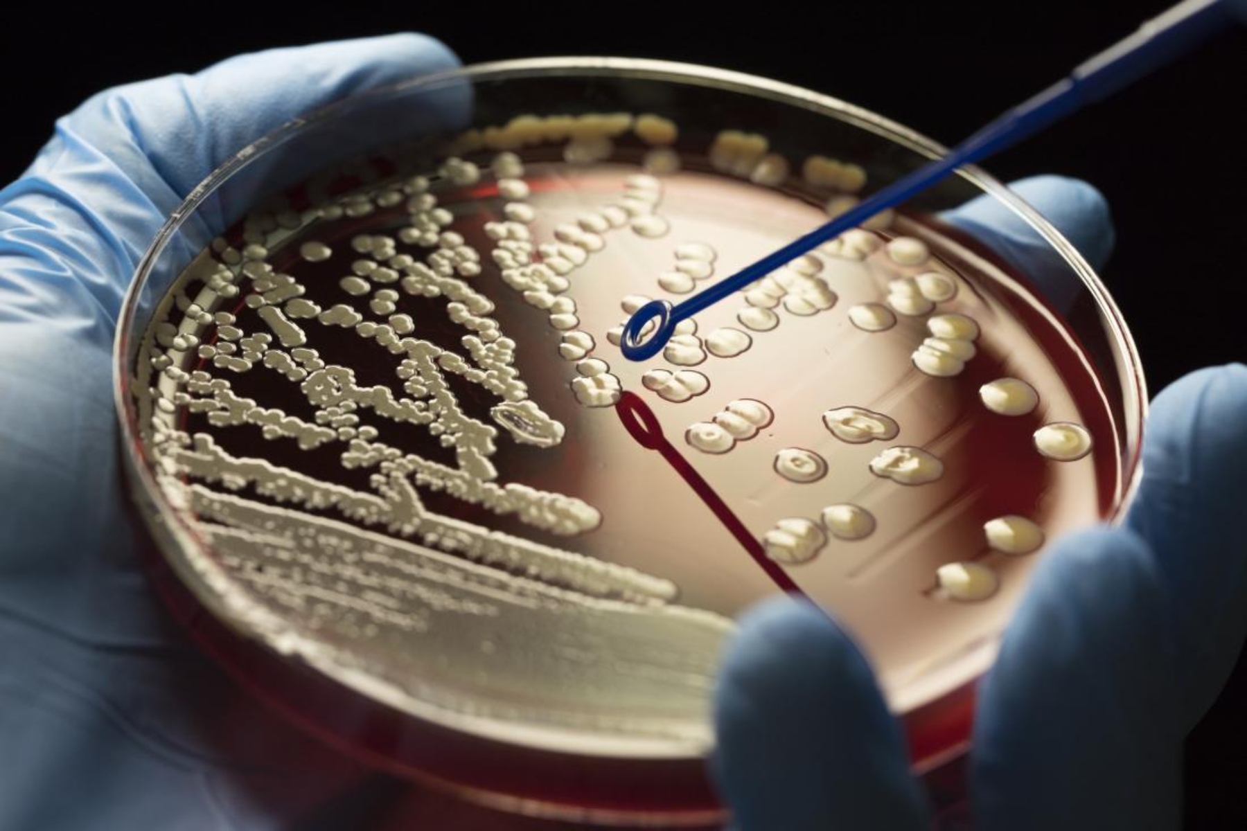 Μικροβιακή αντοχή: Η επόμενη πανδημία βρίσκεται κοντά;