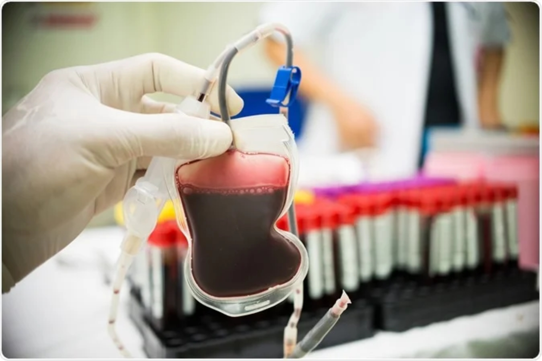 Αιμοδοσία: Το φύλο του αιμοδότη επηρεάζει την επιβίωση του λήπτη;