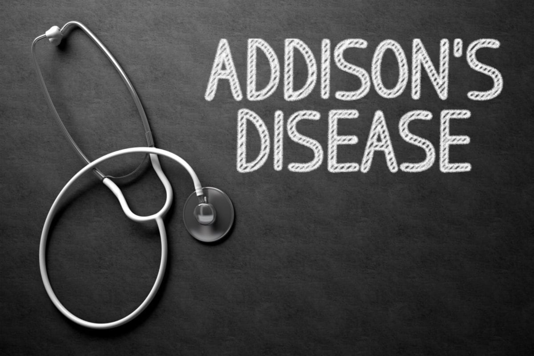 Νόσος Addison: Ποια είναι τα συμπτώματα και με ποιες ασθένειες συνυπάρχει;