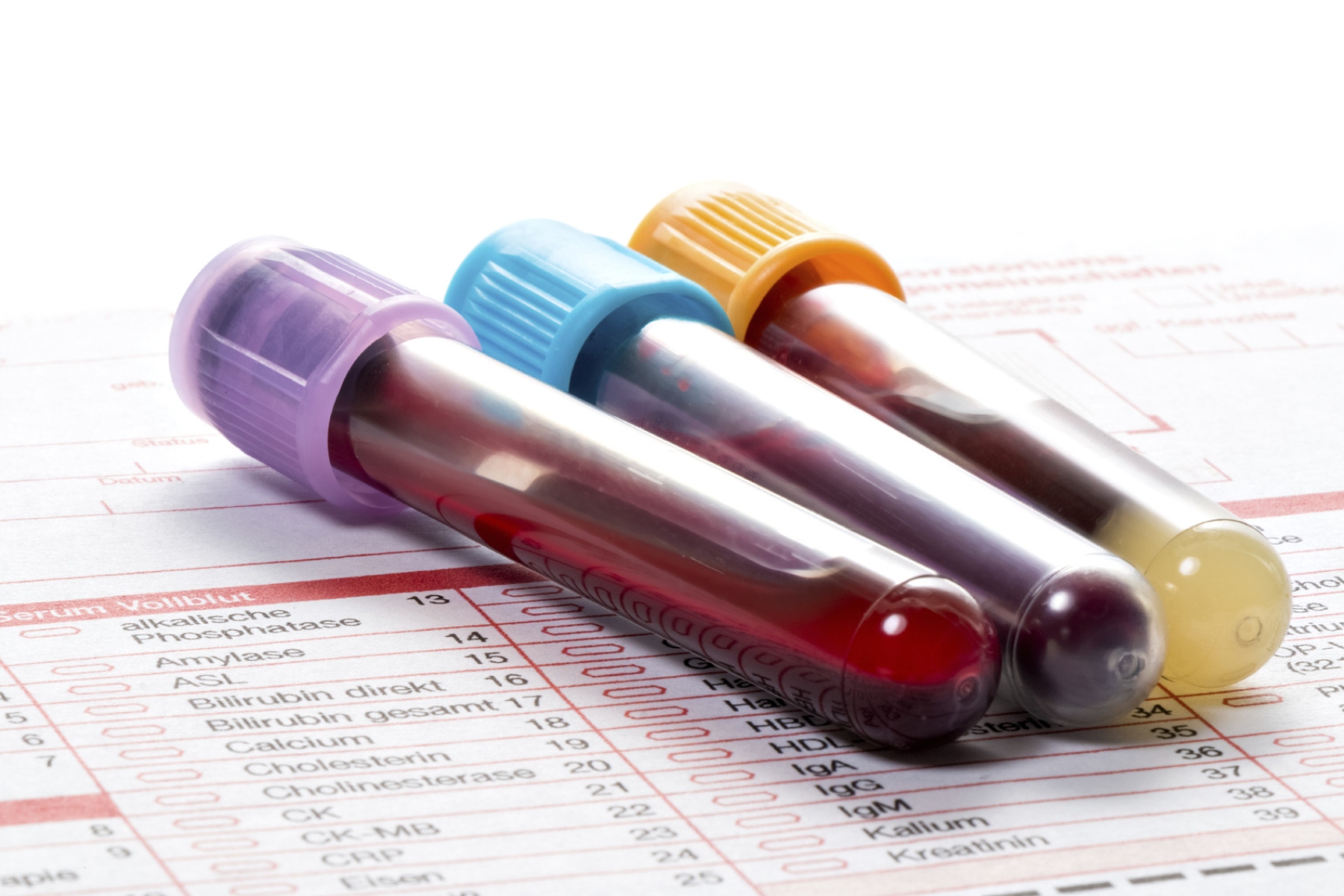 Εξέταση αίματος εμμηνόπαυση: Μπορεί τώρα μια εξέταση αίματος να προβλέψει την εμμηνόπαυση;