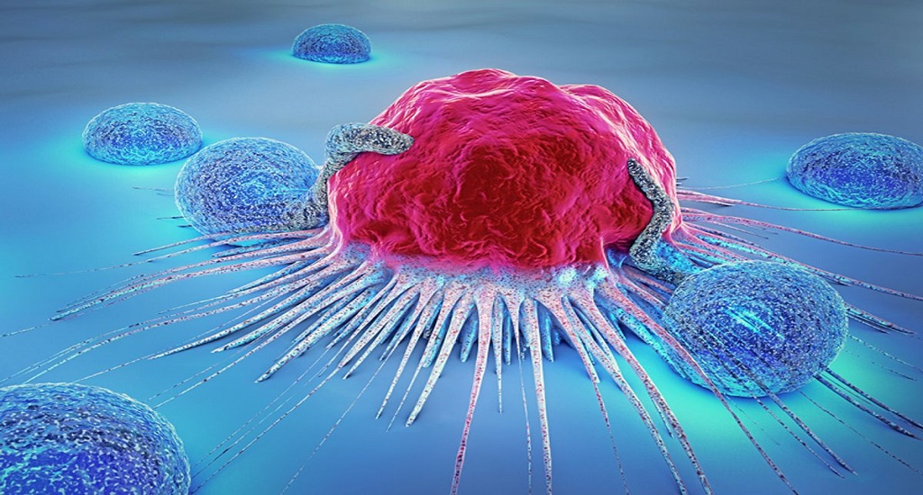 Καρκίνος του Μαστού: Οι όγκοι του διαταράσσουν το ανοσοποιητικό σύστημα, ευνοώντας τη δική τους ανάπτυξη
