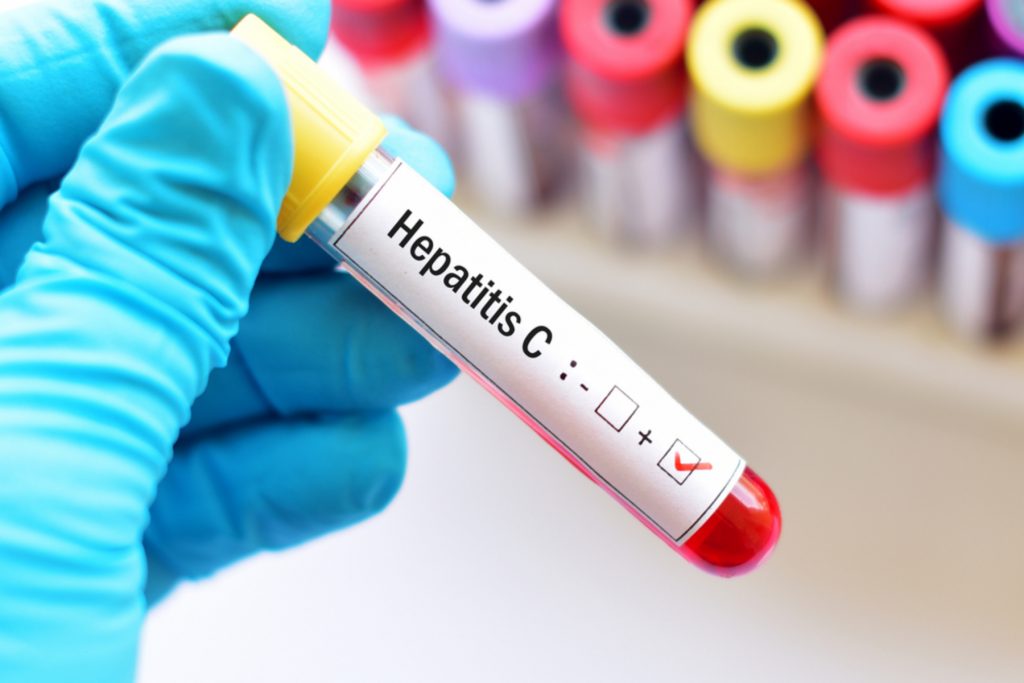 Τι είναι η ηπατίτιδα C και πώς μεταδίδεται;