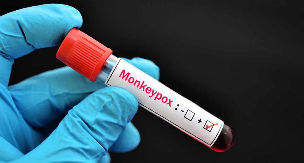 HIV Ασθενείς: Δεν επηρεάζει τα αποτελέσματα της θεραπείας mpox