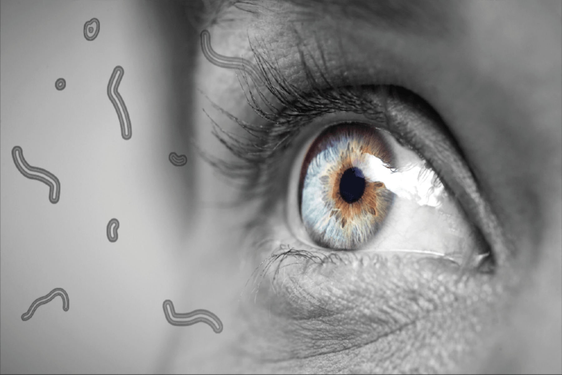Πλωτήρες στα μάτια: Πώς να αντιμετωπίσετε τους πλωτήρες στα μάτια;