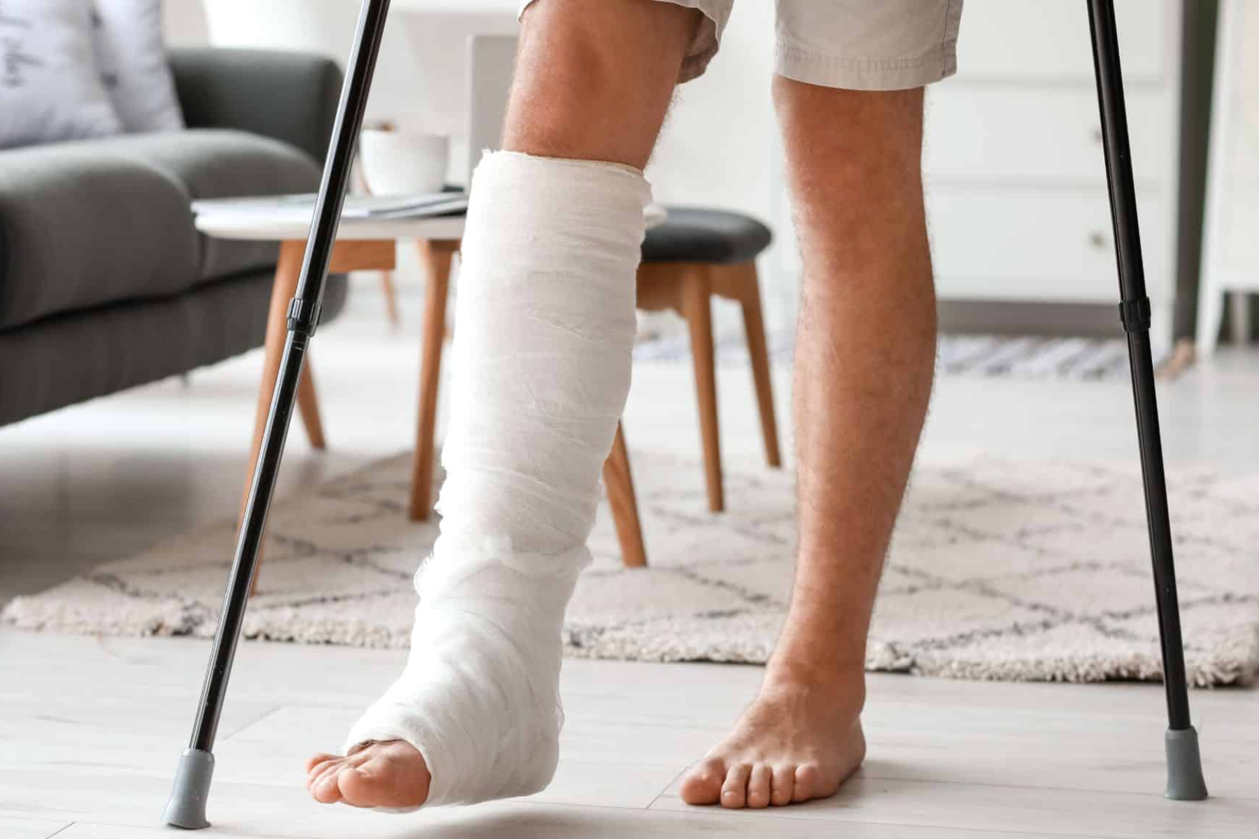 Σπάσιμο ποδιού: Απλά tips για να φροντίσετε το σπασμένο πόδι σας