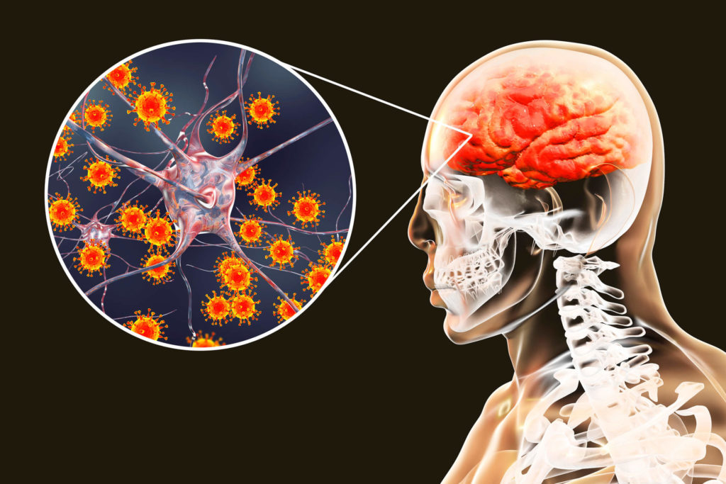 Μακρά Covid: Μελέτη προσδιορίζει τα χαρακτηριστικά των νευρολογικών συμπτωμάτων της λοίμωξης