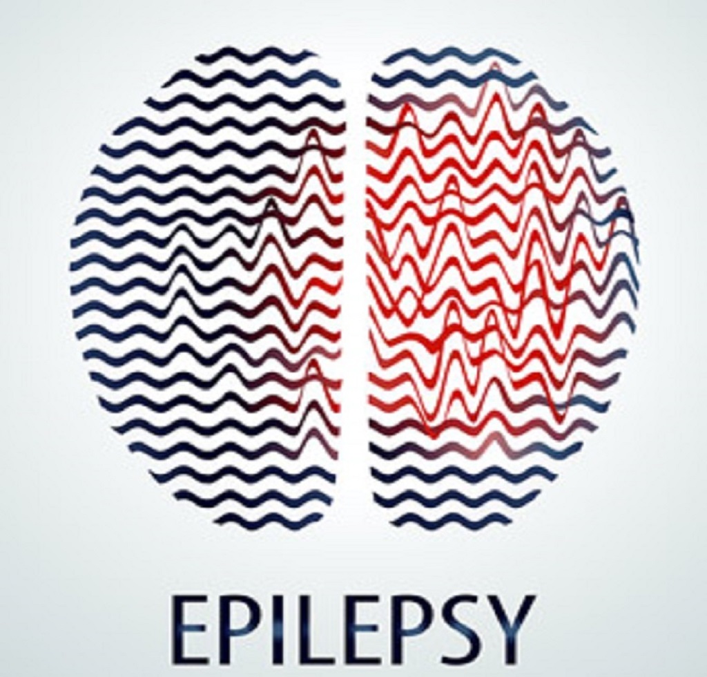Eπιληψία: Η μεταφορά της φροντίδας της χρόνιας διαταραχής πιο κοντά στο σπίτι μπορεί να βελτιώσει τα αποτελέσματα