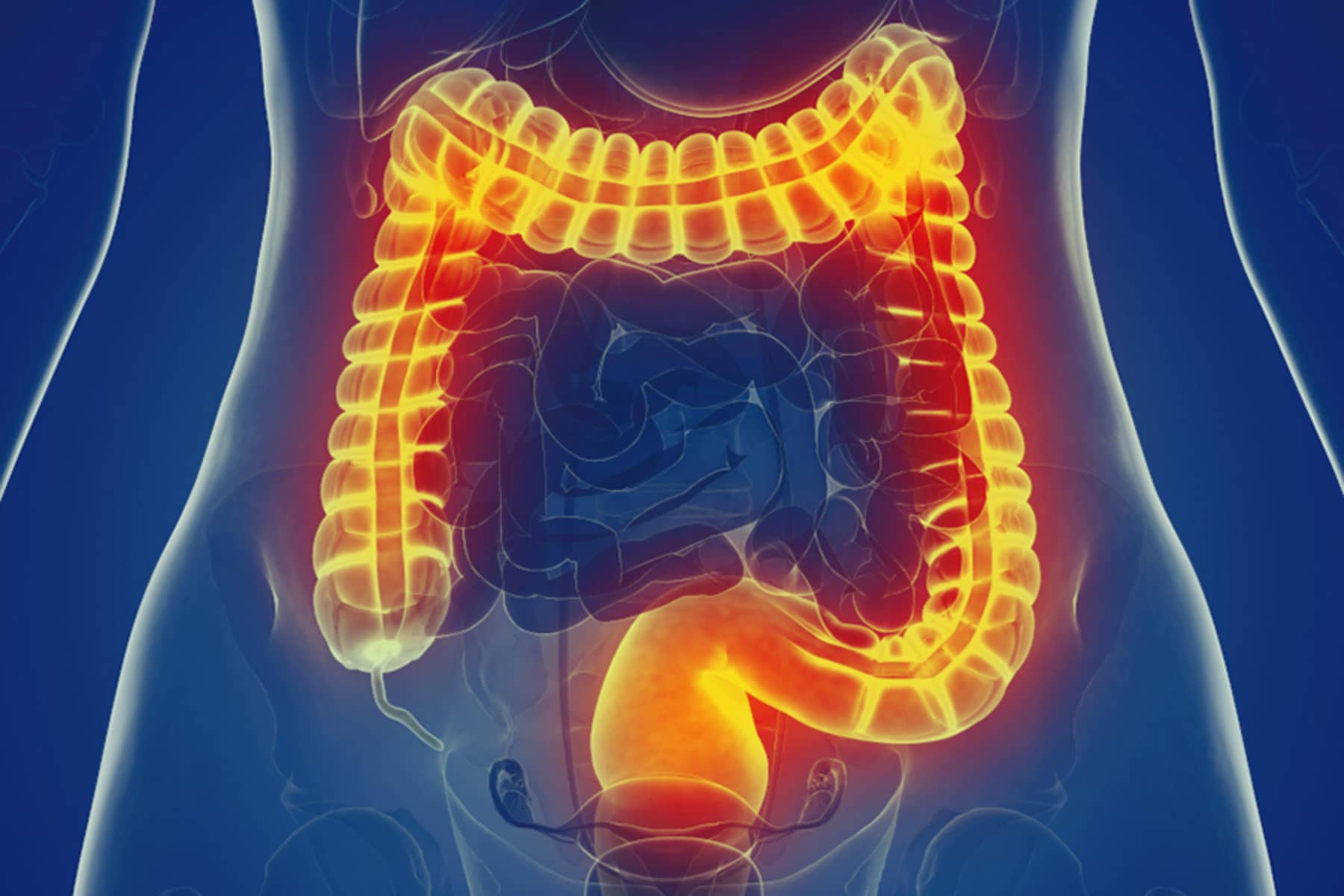 IBS: Πώς θα καταλάβουμε ότι πάσχουμε από το σύνδρομο του ευερέθιστου εντέρου;