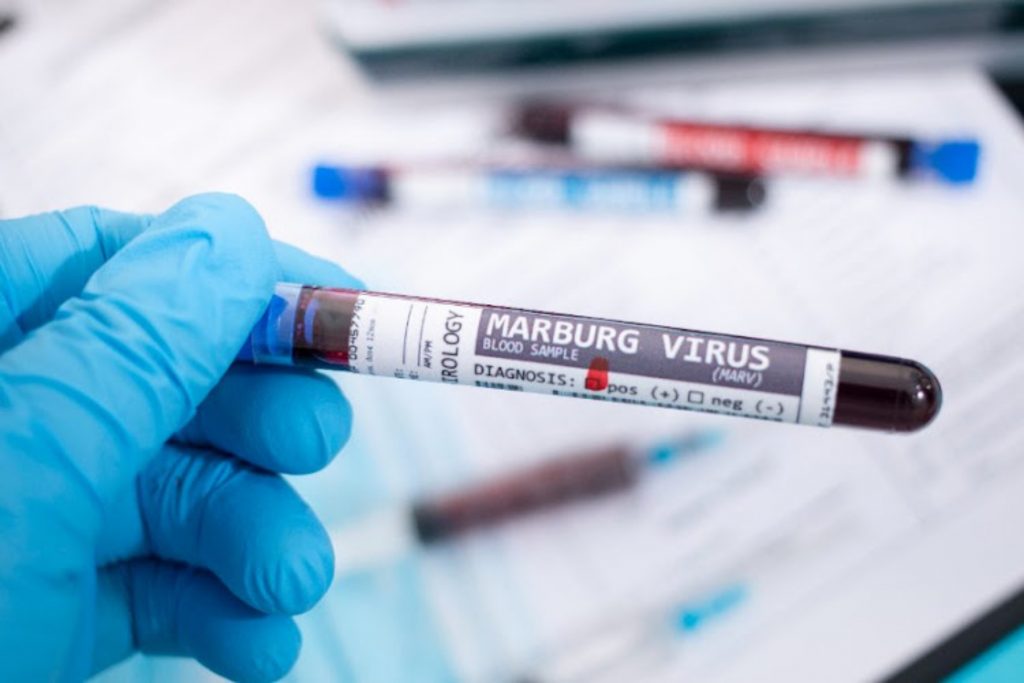 Ο ΠΟΥ κηρύσσει το τέλος της επιδημίας του ιού Marburg στην Ισημερινή Γουινέα