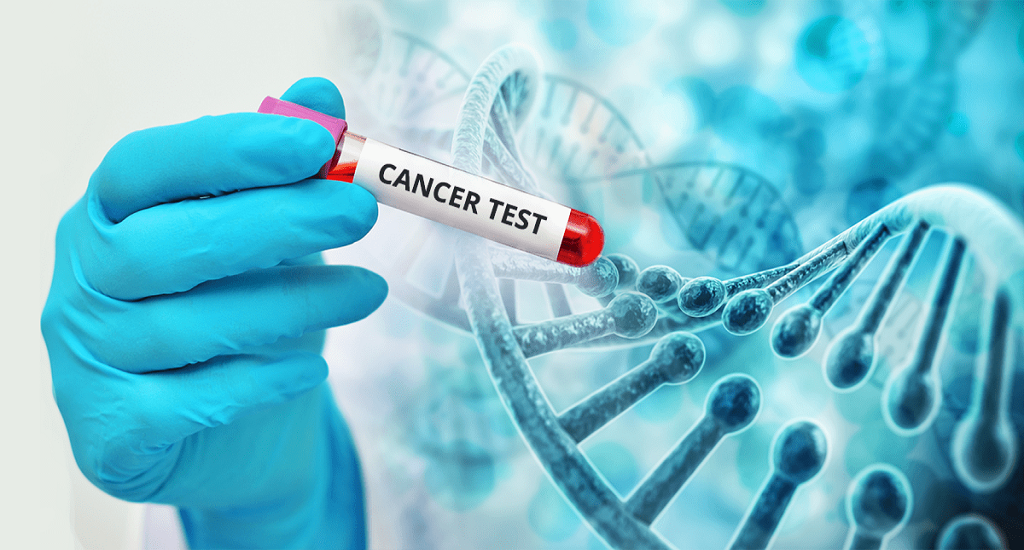 Τεστ Καρκίνος NHS: Ασιοδοξία δίνει τεστ αίματος για την ανίχνευση της πηγής 50 ειδών της νόσου