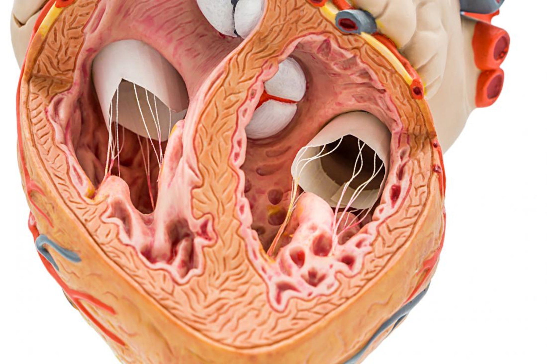 Ασβέστιο καρδιά: Πιθανή βλάβη στην καρδιά από συμπληρώματα ασβεστίου