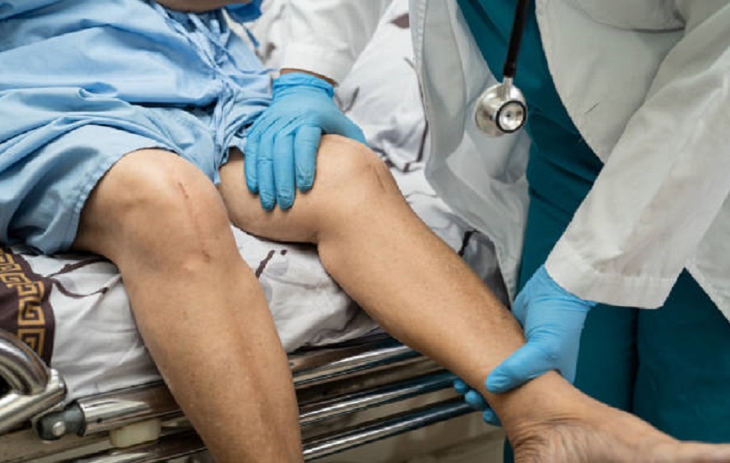 Η αμφίπλευρη ολική αρθροπλαστική γόνατος συνδέεται με αυξημένα ποσοστά επιπλοκών