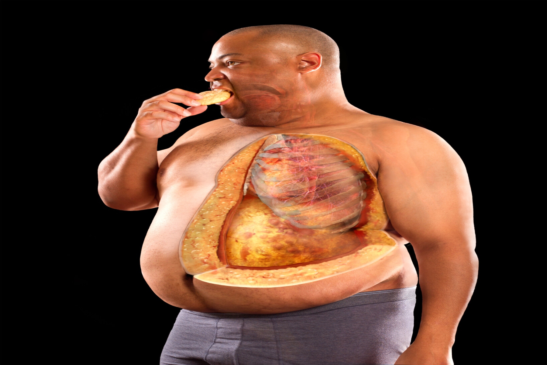 Παχυσαρκία βάρος: Το ποσοστό σωματικού λίπους είναι το πραγματικό μέτρο για την παχυσαρκία