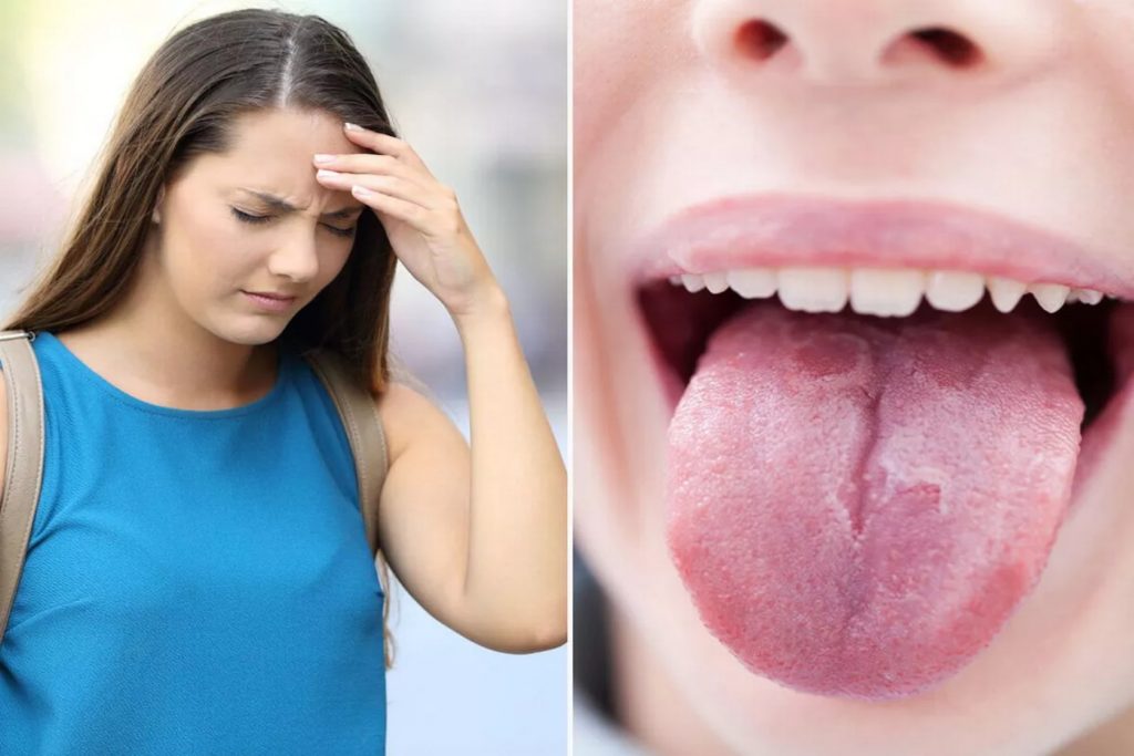 Ασυνήθιστα σημάδια που μπορούν να εμφανιστούν στο στόμα σας αν έχετε ανεπάρκεια βιταμίνης B12