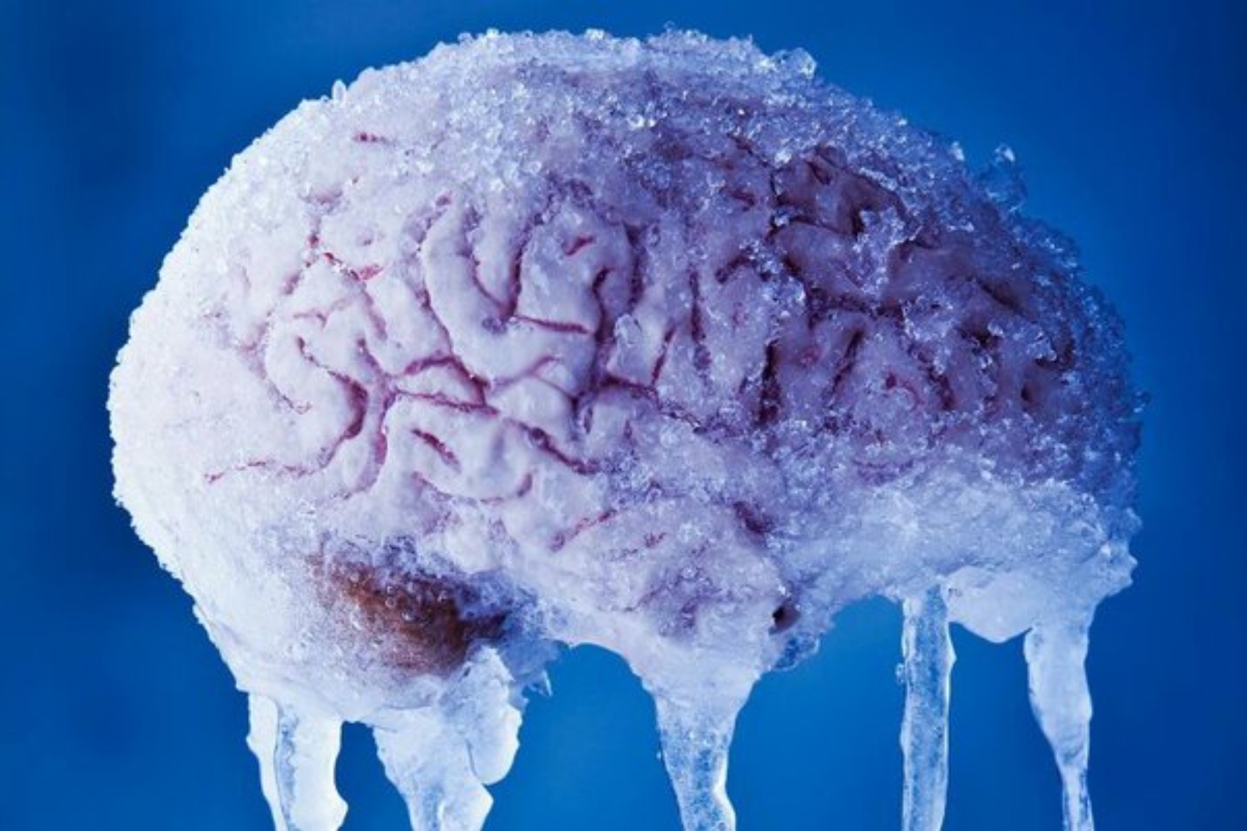 Πάγωμα εγκεφάλου: Τι είναι το Brain Freeze που προκαλείται από το παγωτό;