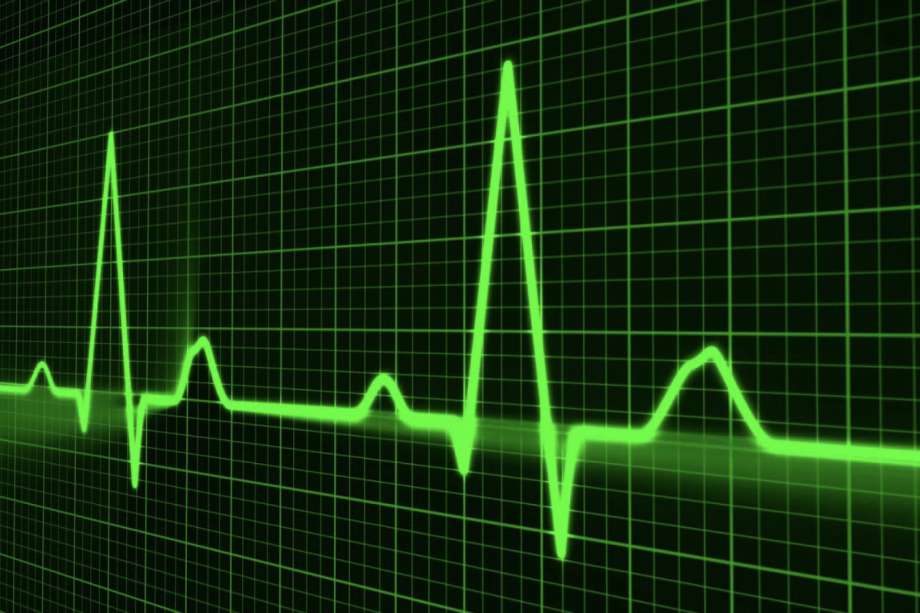Καρδιακοί παλμοί: Πώς μπορείτε να μετρήσετε τους καρδιακούς παλμούς σας;