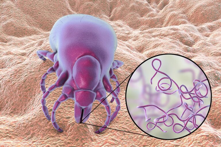 Νόσος Lyme: Η αόρατη απειλή από τα τσιμπούρια
