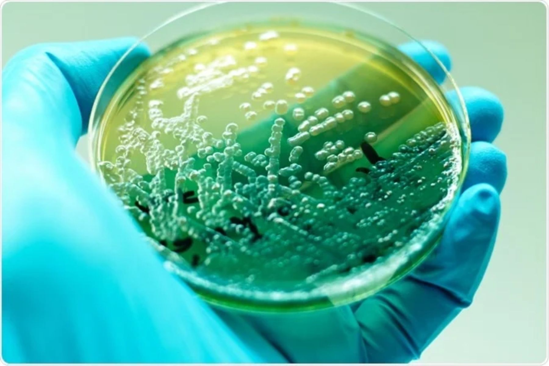 Μικροβιακή ζωή: Η ζωή των μικροβίων στη Γη και το σύμπαν