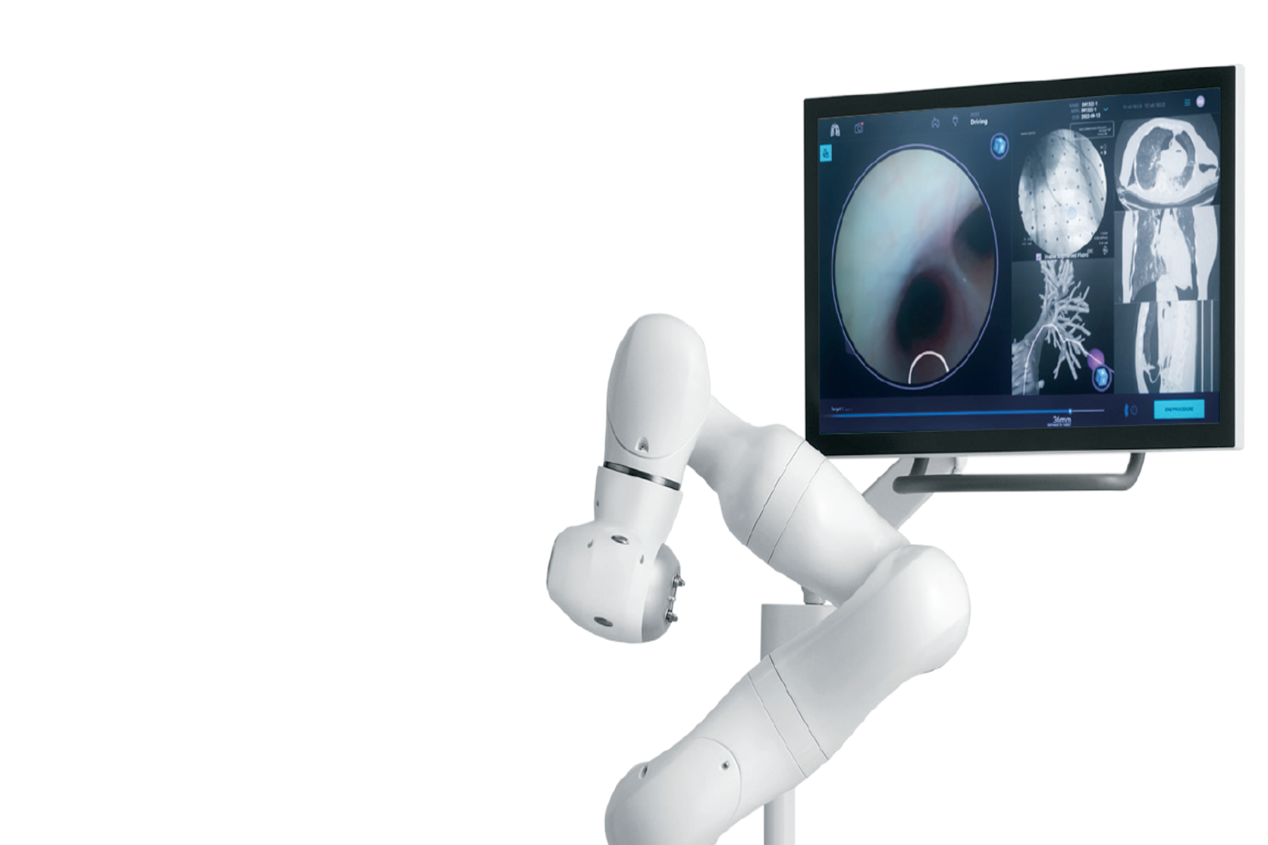 Ρομποτικό σύστημα: Πώς το ρομποτικό σύστημα Galaxy της Noah Medical πηγαίνει βαθιά στους πνεύμονες;