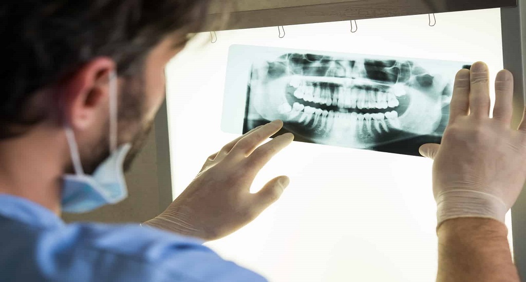 Οδοντική Θεραπεία: Λαμβάνετε ακτινογραφίες στον οδοντίατρο; Είναι πιο ασφαλές από όσο φαντάζεστε