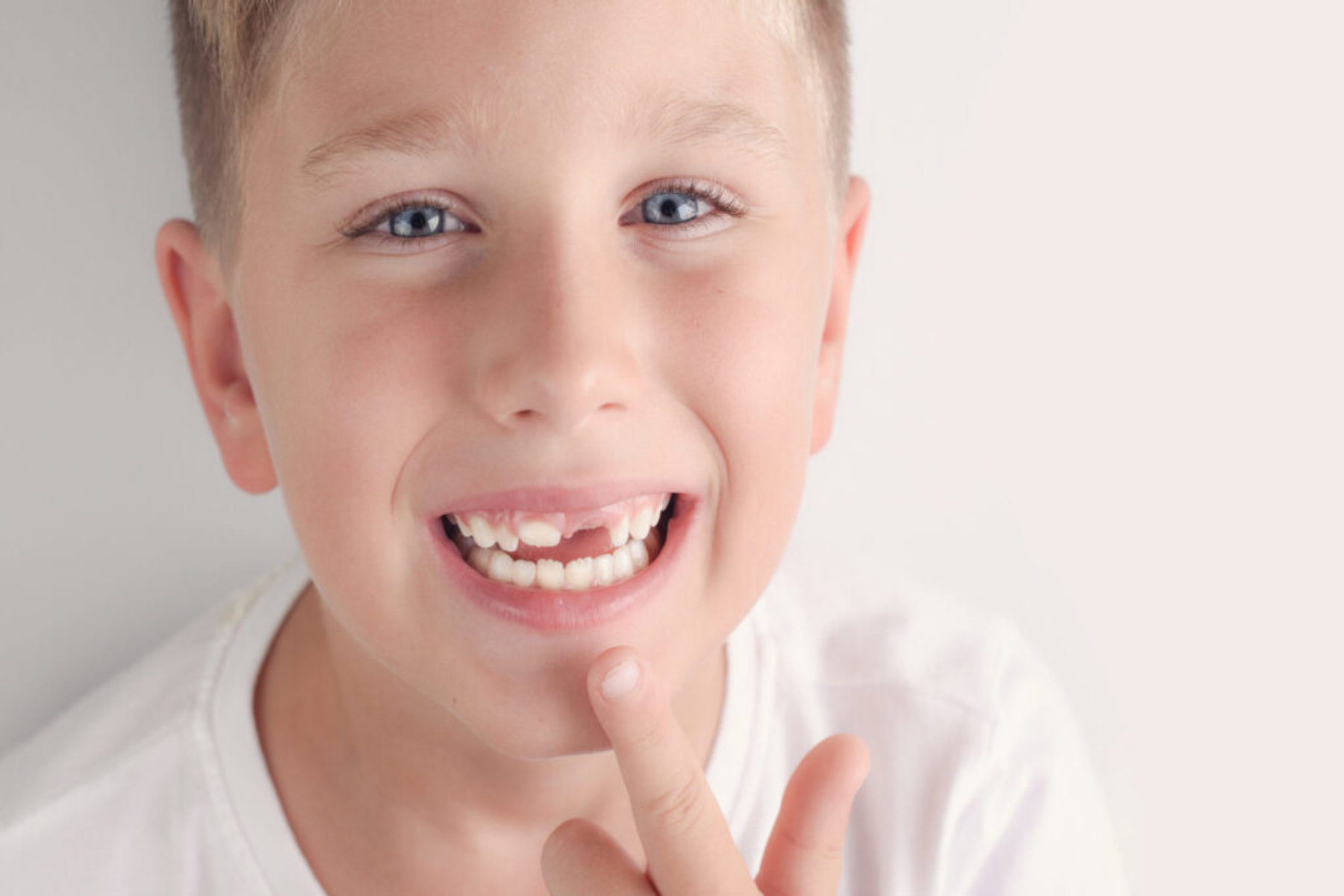 Στοματική Υγεία: Σε ποιες περιπτώσεις αφαιρούνται τα δόντια σε μικρή ηλικία;